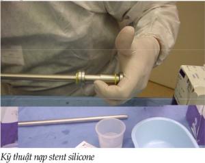 Bước đầu nghiên cứu đặt stent silicon trong điều trị hẹp khí - phế quản