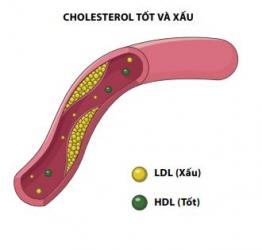 Hiểu Về Cholesterol Tốt Và Cholestero Xấu ?